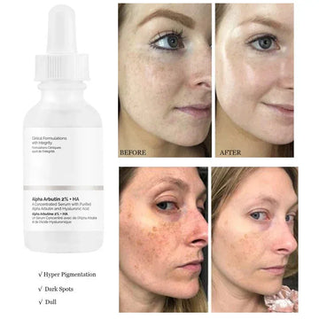 Alpha Arbutin 2% HA + (Original)